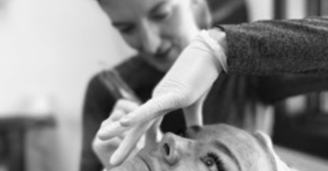 SkinPen Microneedling